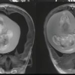 Telemarketing, tradução ou ensino entre profissões mais afetadas pela IA