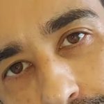 Bebé de 5 meses no hospital após ser atacado por cão no País de Gales