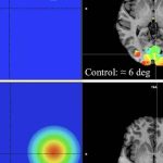 Homem de 350 quilos retirado com grua pela varanda para ir ao hospital