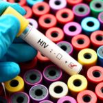 Sociedade Portuguesa de Dermatologia e Venereologia alerta para importância de um correto diagnóstico