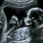 Há um grão aliado do coração e da saúde digestiva. Costuma comprar?