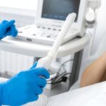 Tratamento com anticorpos pode previnir gripe aviária grave, diz estudo